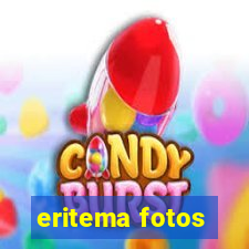 eritema fotos