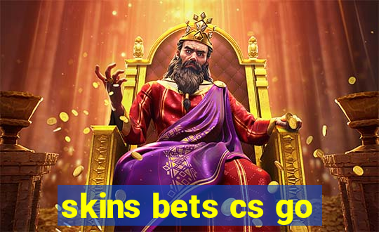 skins bets cs go