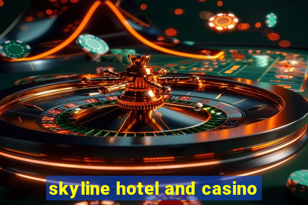 skyline hotel and casino