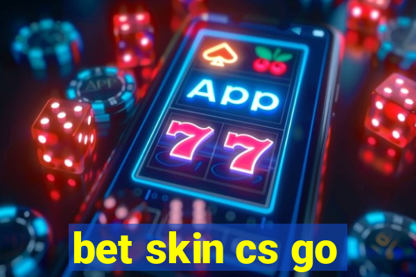 bet skin cs go