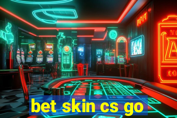 bet skin cs go