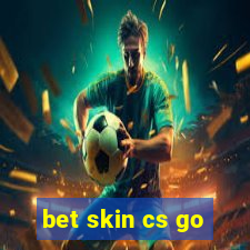 bet skin cs go